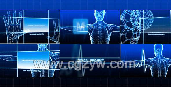 AE模板-医疗人体透视包装动画展示模板