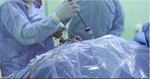 实拍视频-医生腹腔镜手术台操作场景4K视频素材